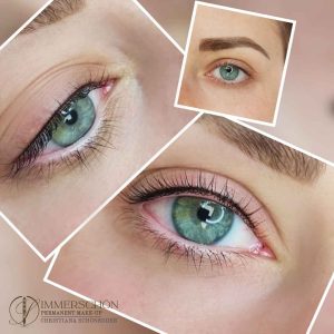 Wimpernkranzverdichtung